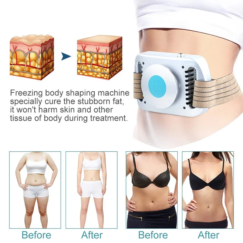 Cryolipolysis machine, fat burner for the stomach and other body parts. Safe.